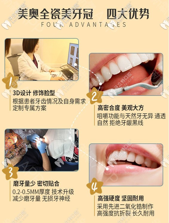 重慶美奧牙科全瓷冠優(yōu)勢(shì)圖