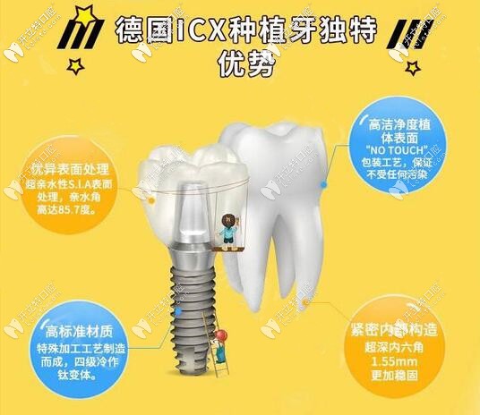 蘇州美奧德國(guó)ICX種植牙價(jià)格