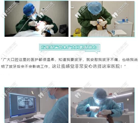 舌側(cè)矯正治療過程