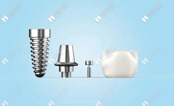 廣州柏德口腔3顆美國皓圣種植體僅需13800元