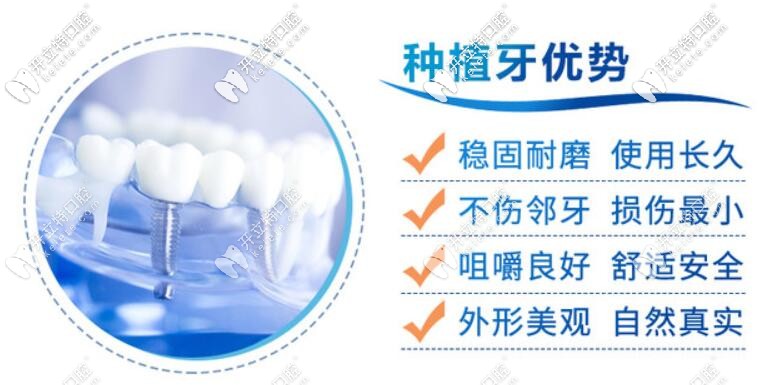 種植牙優(yōu)勢