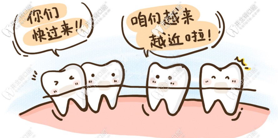 時(shí)代天使隱形矯正