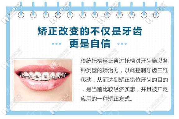 傳統(tǒng)的鋼絲矯正優(yōu)勢