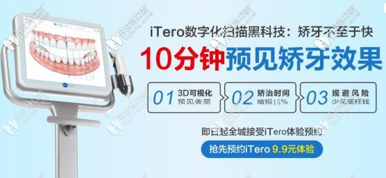 itero口掃價格惠州致美口腔