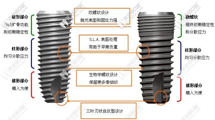 種植體的優(yōu)勢(shì)