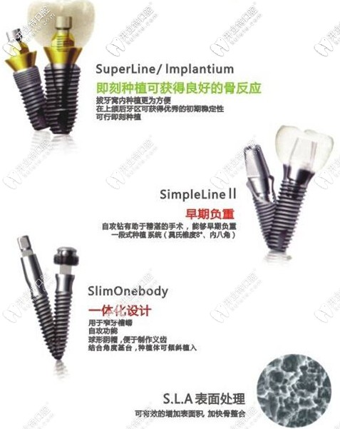 登騰種植體的特點(diǎn)