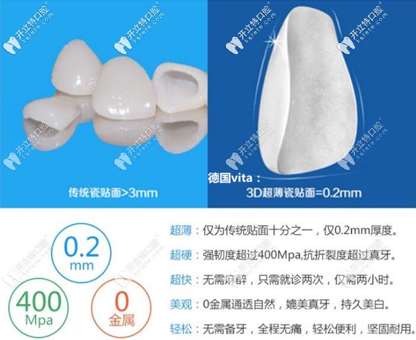 德國vita超薄玻璃陶瓷和琥珀瓷貼面價格的區(qū)別