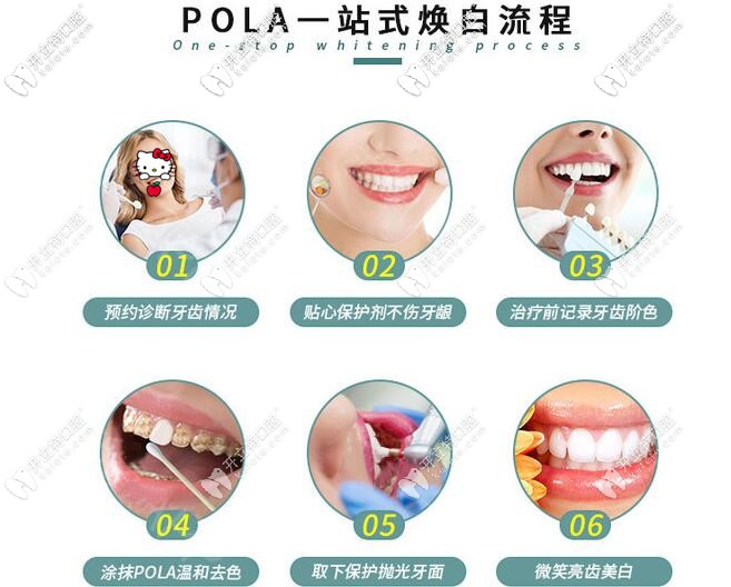 昆明柏德pola牙齒美白步驟