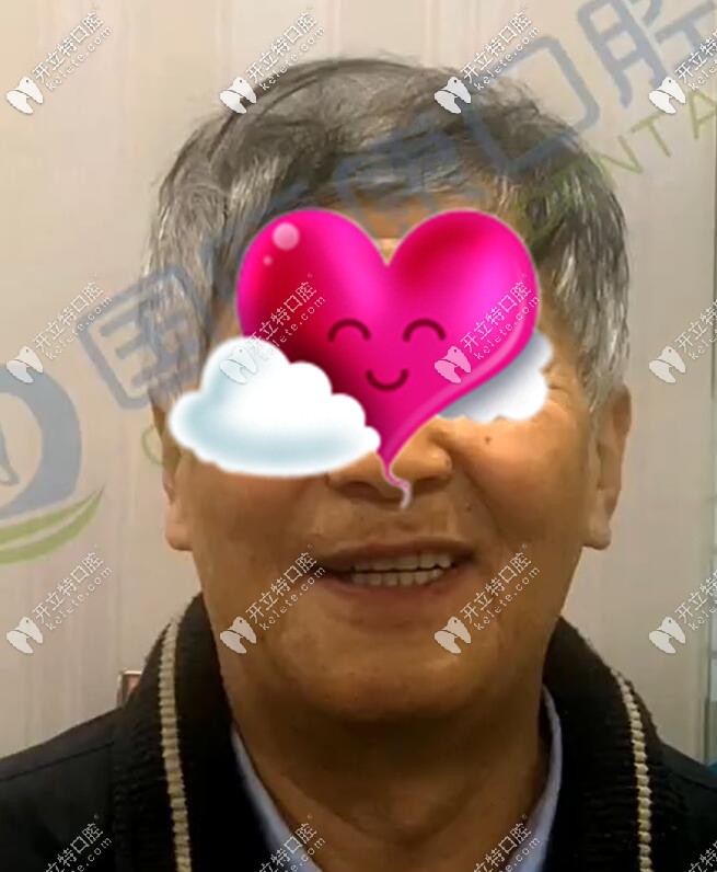 71歲老人做全口種植牙后效果圖