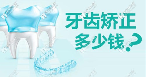 做牙齒矯正需要多少錢