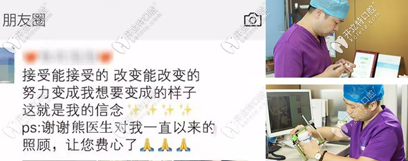 在廣州圣貝牙科花兩萬(wàn)多元做矯正的效果 在廣州圣貝牙科花兩萬(wàn)多元做矯正的效果