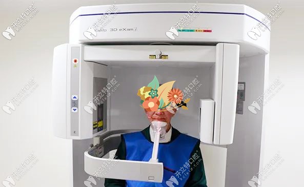 廣州柏德口腔高齡種植牙案例