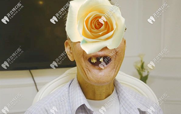 老伯做全口種植牙前的口內(nèi)照