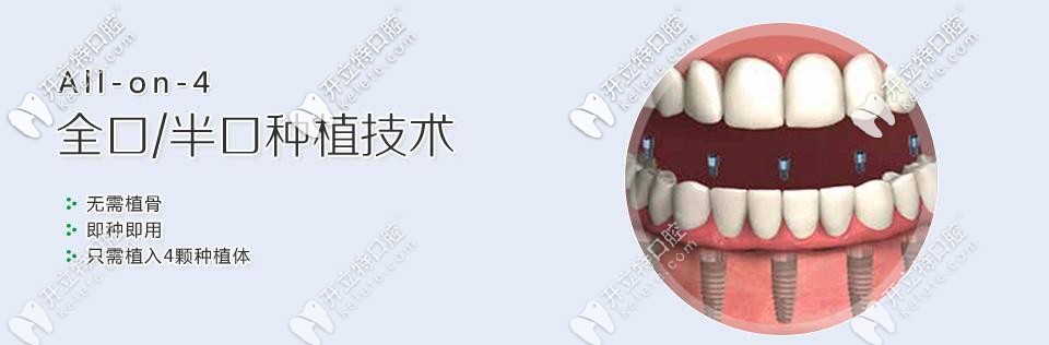 ALL-on-4種植牙優(yōu)勢