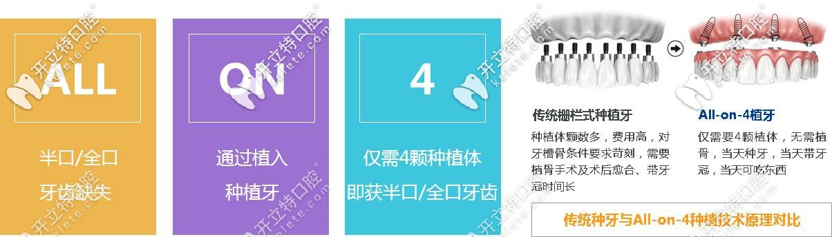 傳統(tǒng)種植牙和all-on-4的對比
