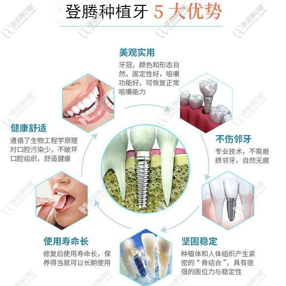深圳正夫口腔韓國(guó)登騰種植牙優(yōu)勢(shì)