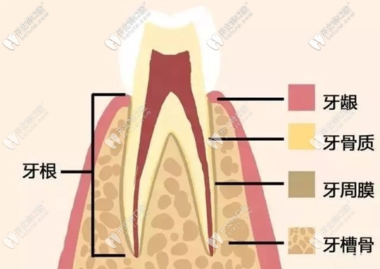 什么是牙周植骨手術(shù)