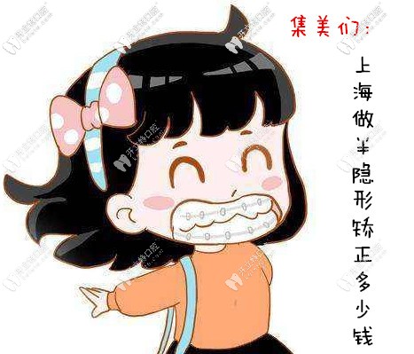 送來上海半隱形矯正牙齒的價格表,各品牌的正畸費(fèi)用都有哦