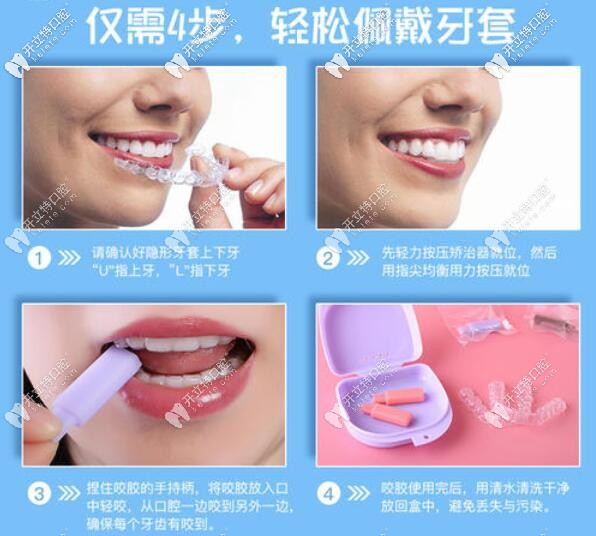 廈門(mén)峰煜口腔隱適美牙套