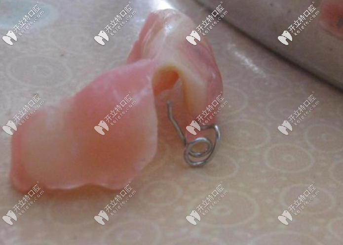 牙齒矯正斜導的作用