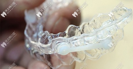 隱形牙套
