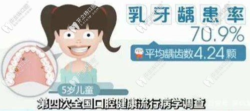 乳牙患齲齒的概率極高