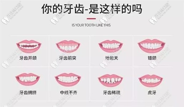 各種畸形的牙齒圖片