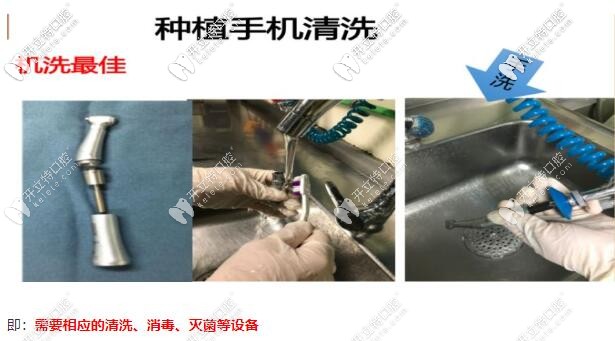 種植牙手術預防感染