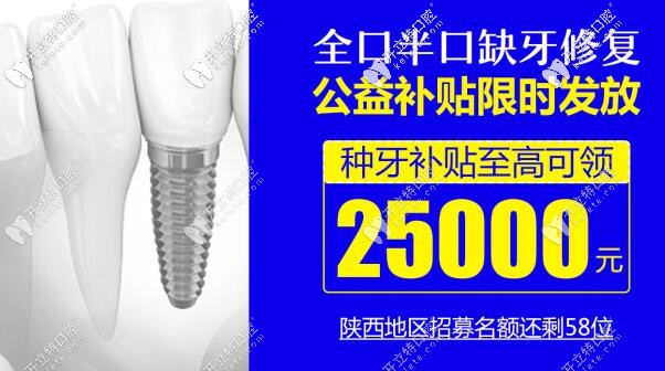 西安種一口牙報價來啦,1顆諾貝爾種植牙的價格就可恢復半口