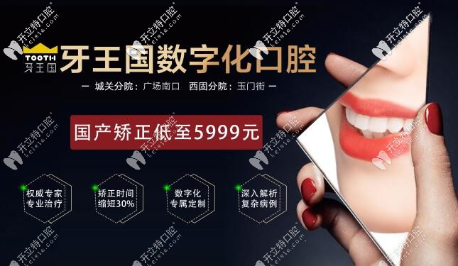 比隱形牙套價格便宜又快速的金屬矯正只需5999,蘭州人手慢無