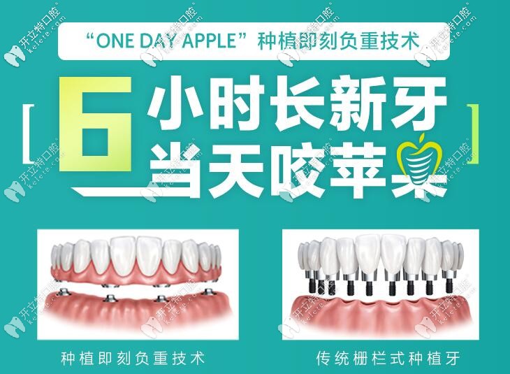 福清維樂(lè)口腔即刻種植牙