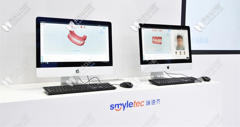 瑞速齊隱形牙套的效果展示