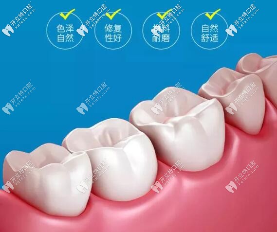 美學(xué)修復(fù)