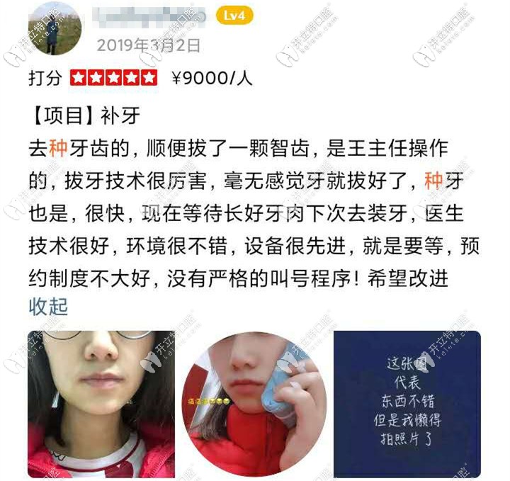 醫(yī)生采用即拔即種的技術幫美女恢復了牙齒，就等之后的牙冠啦