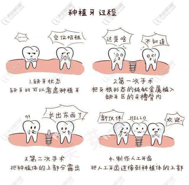 種植牙的過(guò)程