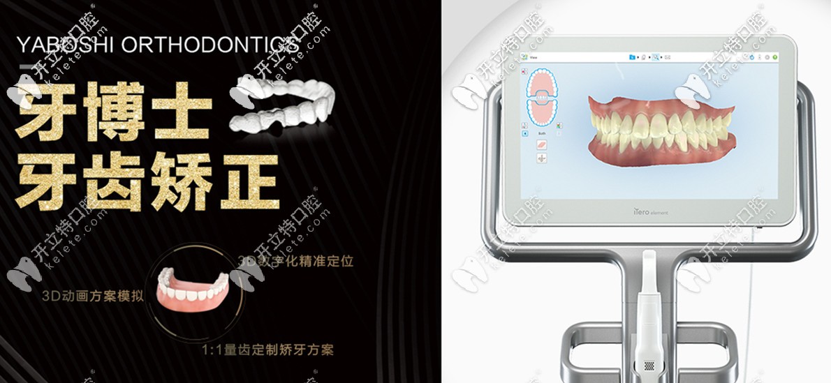 牙博士牙齒矯正的特點(diǎn)