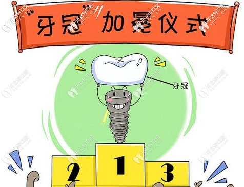 重慶做一顆牙冠的價(jià)格