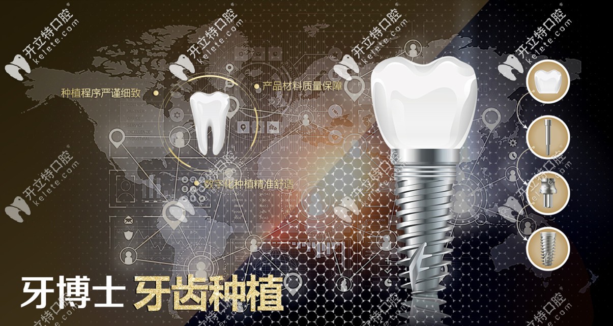 成佳牙博士口腔種植技術(shù)