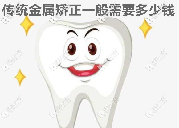 我知道傳統(tǒng)金屬鋼托矯正需要多少錢,它比隱形的價(jià)格還劃算