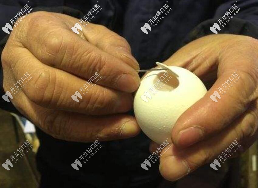 上頜竇底骨增量手術(shù)（俗稱上頜竇底外/內(nèi)提升術(shù)）