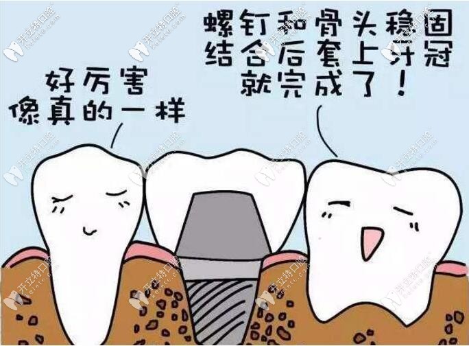 種植牙能和真牙一樣嗎