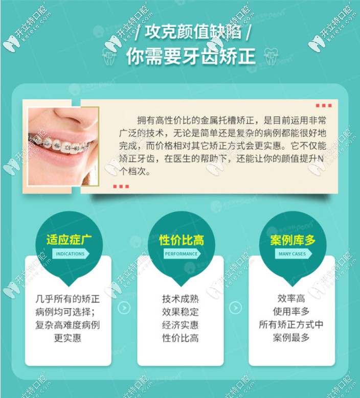 普通金屬托槽矯正的優(yōu)勢