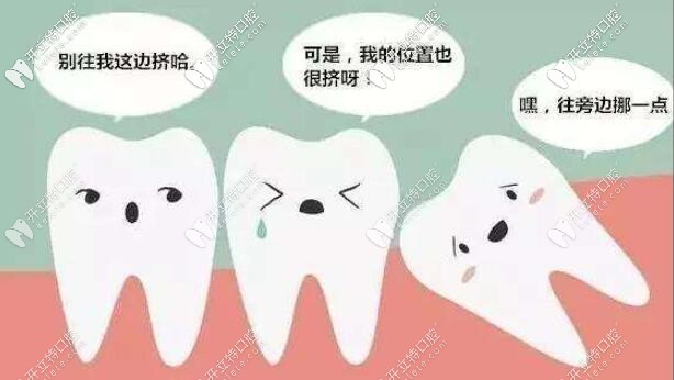 矯正牙齒擁擠需要拔牙嗎