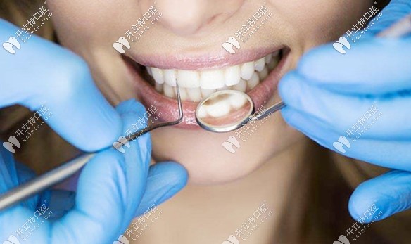 張寧醫(yī)生分享牙周病預(yù)防小知識(shí)