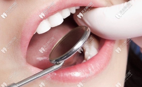 華志熙醫(yī)生建議一定要先治療牙病再矯正