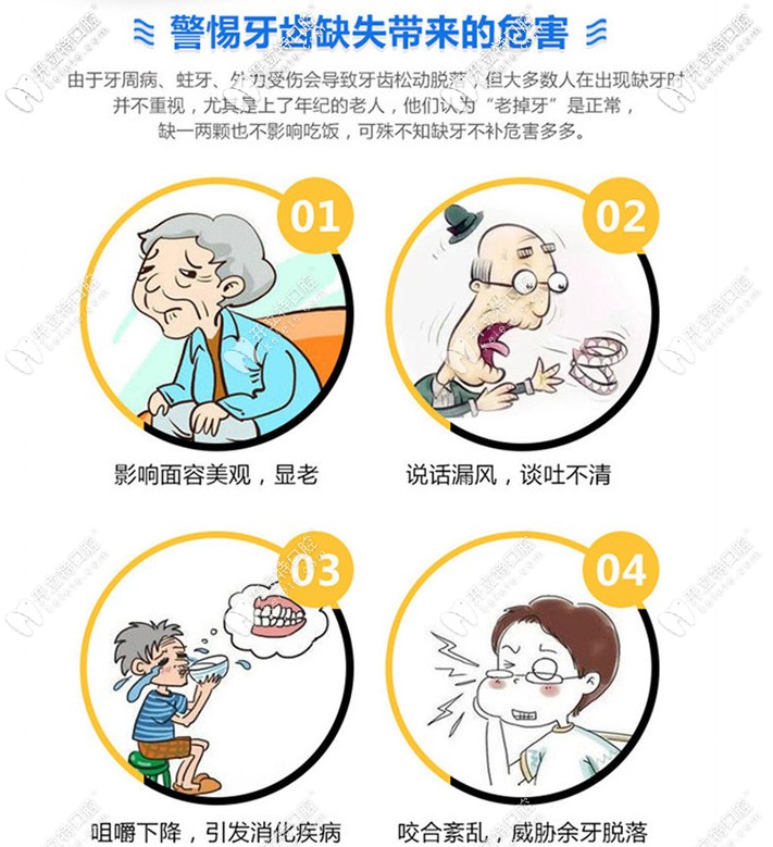 長(zhǎng)期缺牙的危害