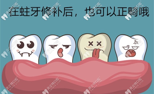 蛀牙顆數(shù)超過(guò)20顆可能就正畸無(wú)望了