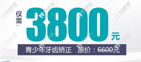 鋼絲牙套3800元起