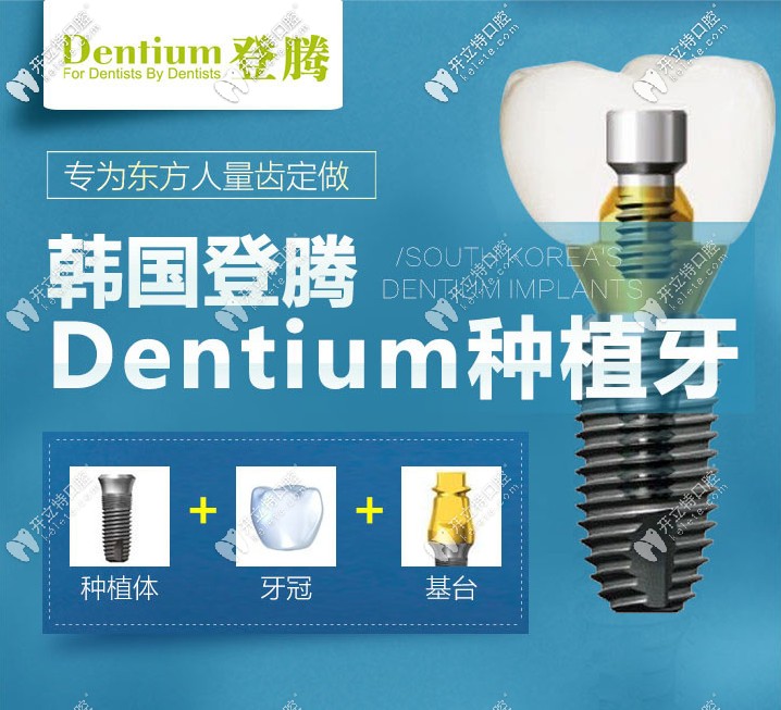 南京做韓國(guó)登騰種植牙多少錢(qián)？它的使用壽命有多長(zhǎng)呢？