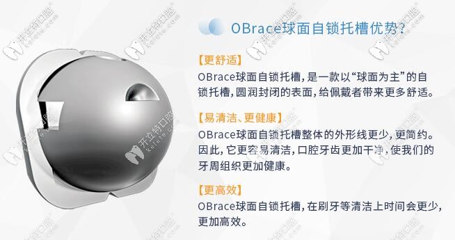 OBrace球面自鎖托槽的優(yōu)勢